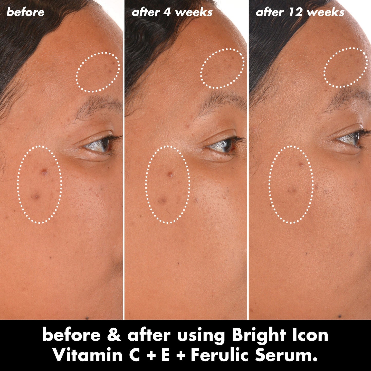 bright-icon-vitamin-c-e-ferulic-serum-n2 0226_EDU_BrightIconVitC_BA_Chanel_TRIPTYCH_c58f2fc8-209d-414f-9ba3-666a07a94887.jpg