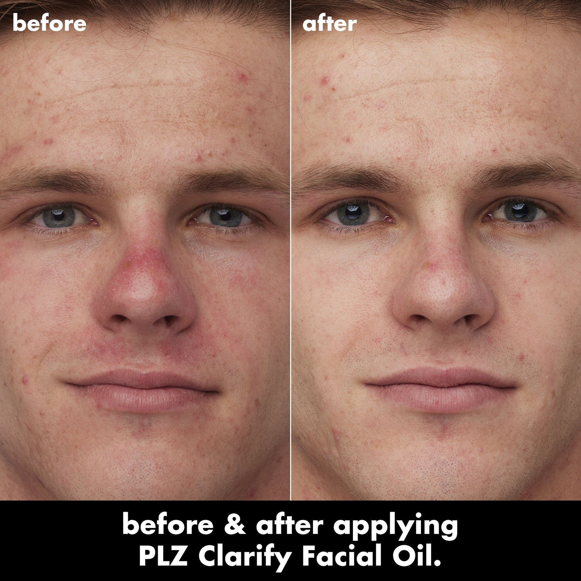 plz-clarify-facial-oil-k6 0326_EDU_PlzClarify_BA_Caleb.jpg
