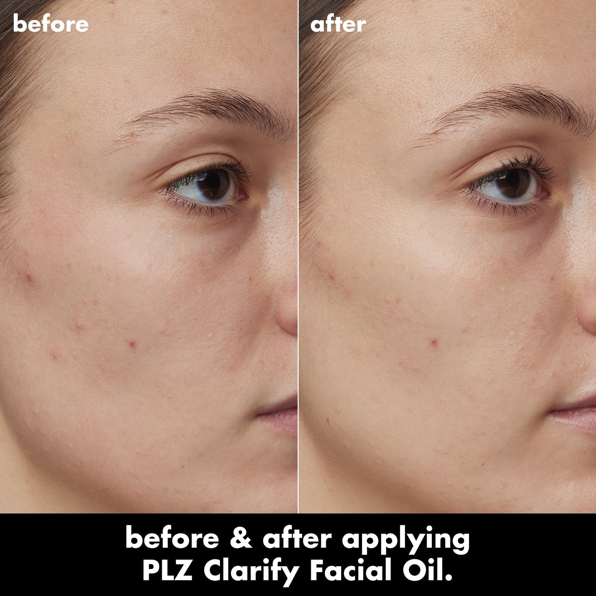 plz-clarify-facial-oil-k6 0326_EDU_PlzClarify_BA_Kelly.jpg