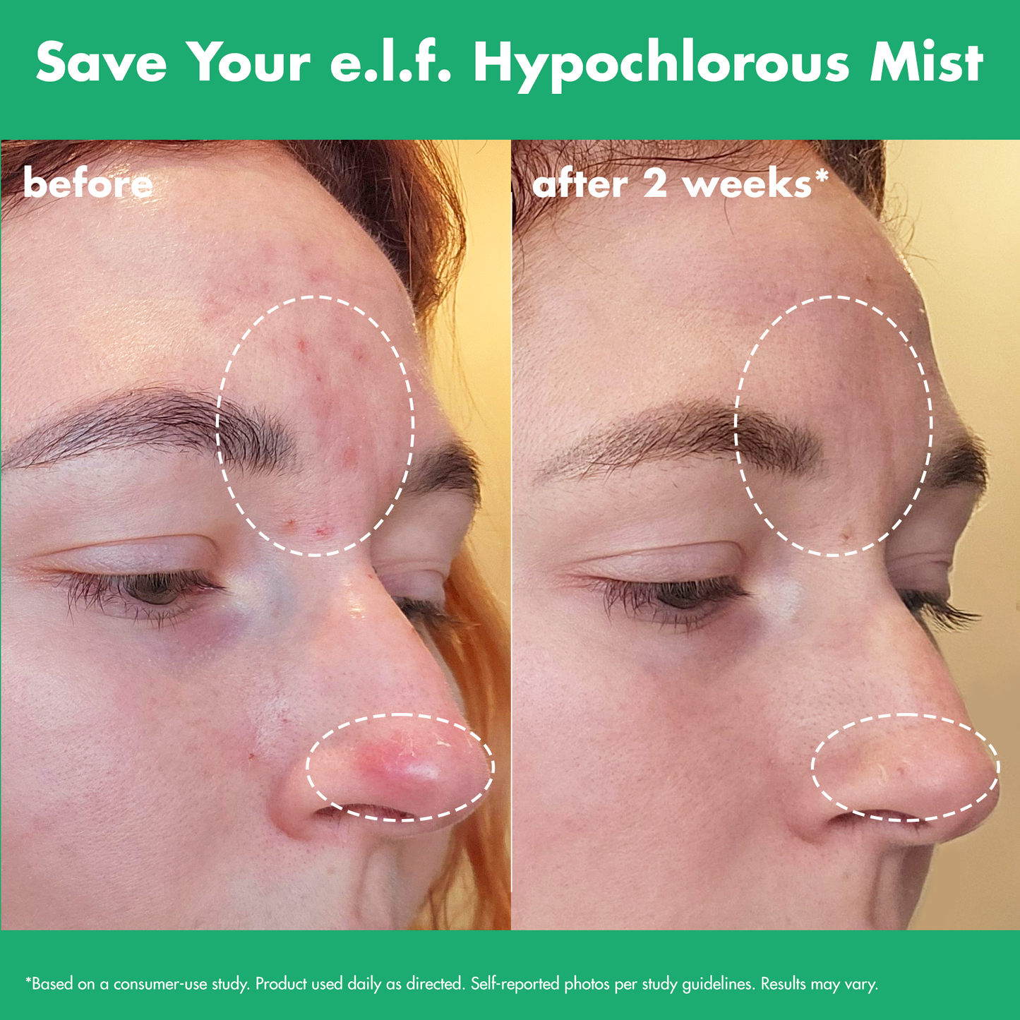 save-your-e-l-f-hypochlorous-mist-j5 FA26_EDUCATION_SAVEYOURELF_USAGE_BA1_WITHOUT_CLAIMS.png